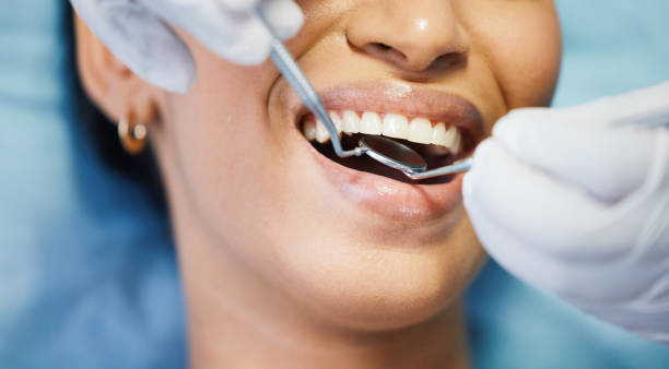 Best Knocked-Out Tooth Emergency  in Pea Ridge, FL